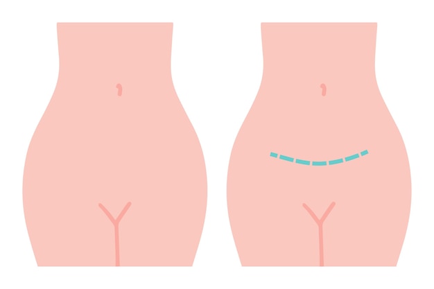 gynecological surgery problem with reproductive system