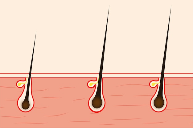 view of scalp hair demonstrating follicular units. These are naturally... |  Download Scientific Diagram