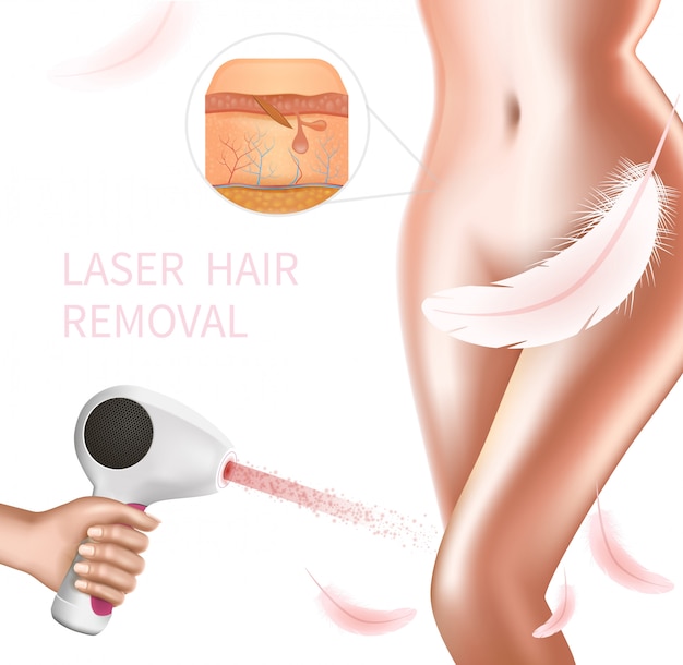 Vettore procedura di rimozione dei peli laser sull'area bikini femminile