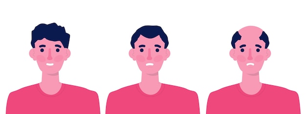 Hair stages loss types of baldness on male head