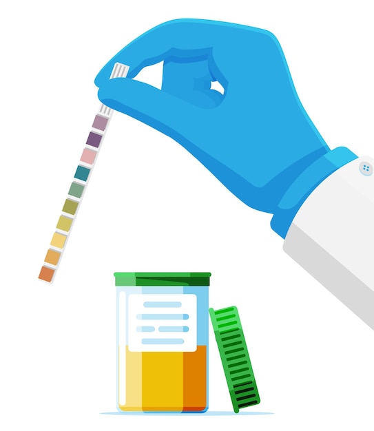 Vector hand of doctor holding urine ph test strip in jar