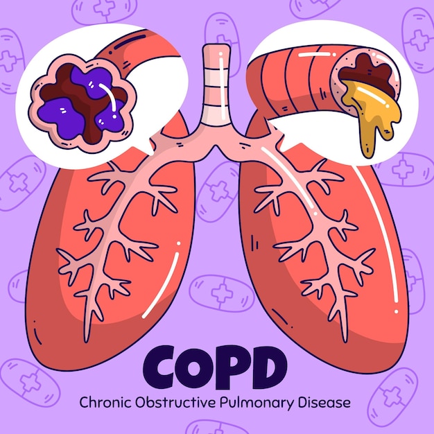 Hand drawn copd illustration