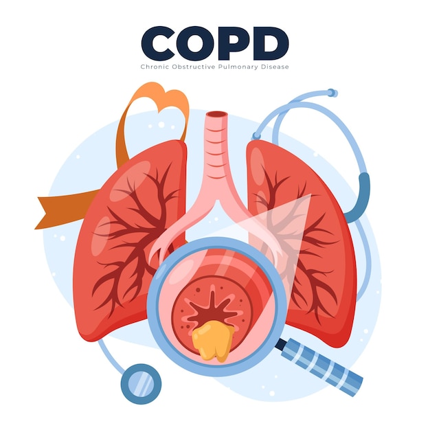 Hand drawn flat copd illustration