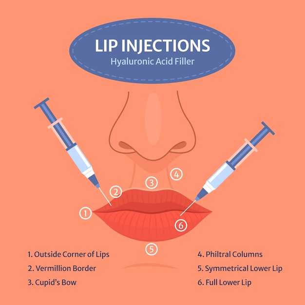 Vector hand drawn flat design lip filler infographic