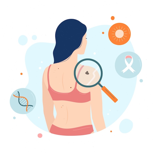 Hand drawn flat design melanoma illustration