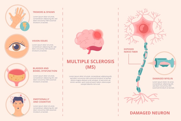 Infografica sulla sclerosi multipla dal design piatto disegnato a mano