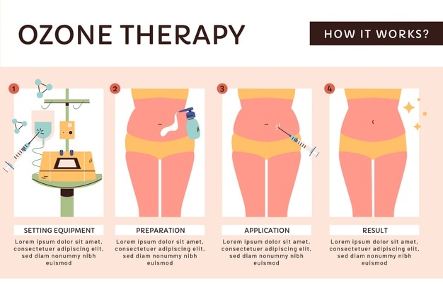 Vettore infografica di ozonoterapia disegnata a mano