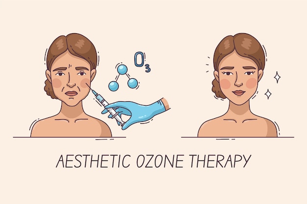 hand drawn ozone therapy infographic