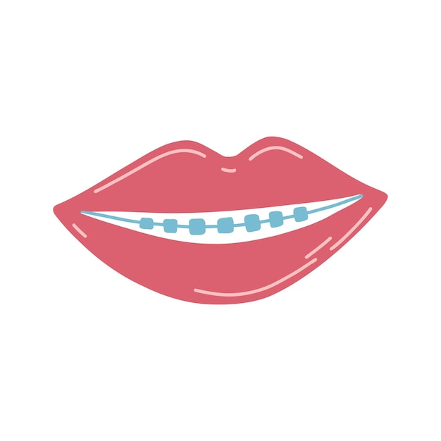 Vector hand getekende lippen met tanden en beugels in cartoon vlakke stijl vectorillustratie van orthodontische gezondheidszorg concept mondhygiëne voor stickers webdesign poster briefkaart stof afdrukken