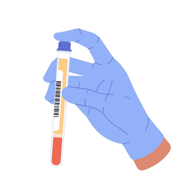 Рука держит плазму крови in vitro на белом фоне Анализ крови в трубке