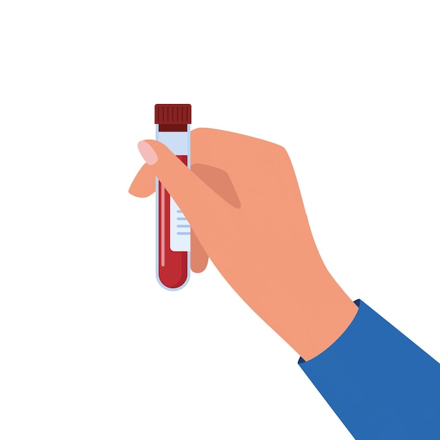 Hand holding test tube with blood Laboratory research Equipment for analysis