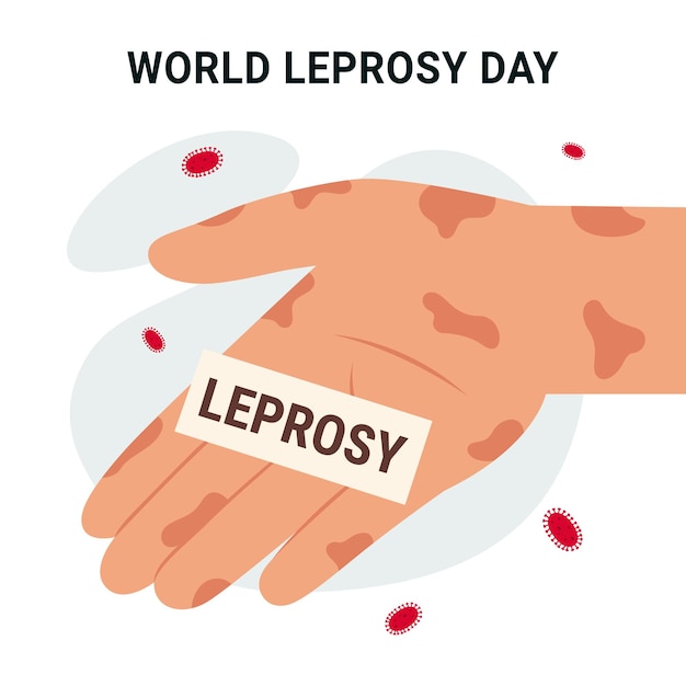 A hand with a sign that says world leprosy day