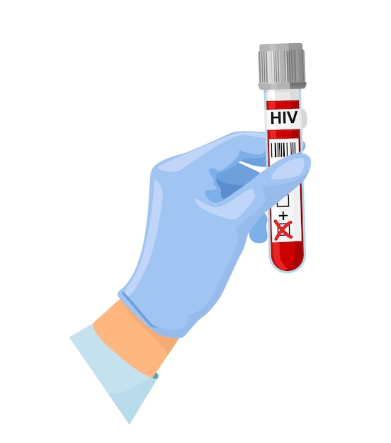 AIDS HIV 세계 에이즈의 날 12월 1일 혈액 검사에 대한 혈액 검사의 시험관을 든 손