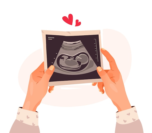 Vector hands holding a photo of a baby on ultrasound scan in the womb. ultrasound of the child. pregnancy.