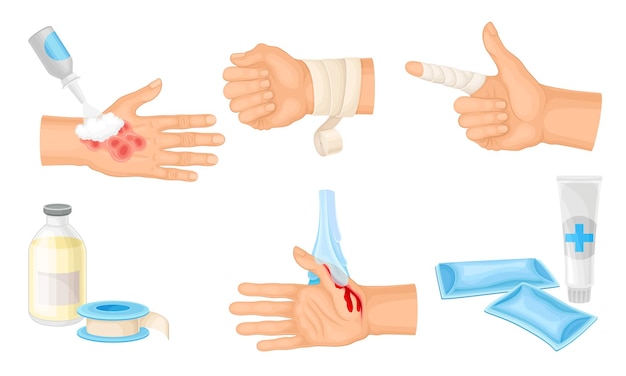 Vector hands with injured skin and procedures of bandaging and wound cleaning vector set