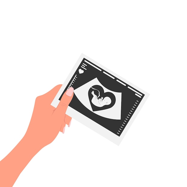 happy pregnant girl holding a picture of her baby's ultrasound in her hand against