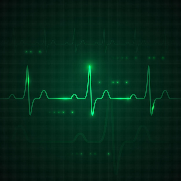 Hartpuls op groen display. hartslagafbeelding of cardiogram.