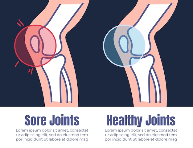 Иллюстрация графического дизайна концепции рентгена здоровых и травмированных мышц суставов