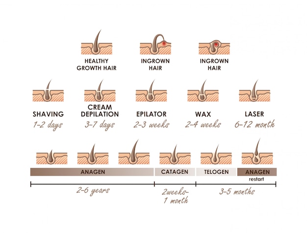 Вектор Здоровый рост волос. вросший волос. фазы роста волос. различные методы удаления волос. типы эпиляции со сроками действия