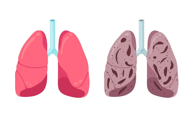 건강하고 건강에 해로운 폐는 개념 인간의 호흡기 시스템 내부 장기를 강하고 비교합니다.