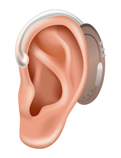 Hearing aid Sound amplifier for patients with hearing loss Medicine and health Realistic object behind the ear Treatment and prosthetics in otolaryngology