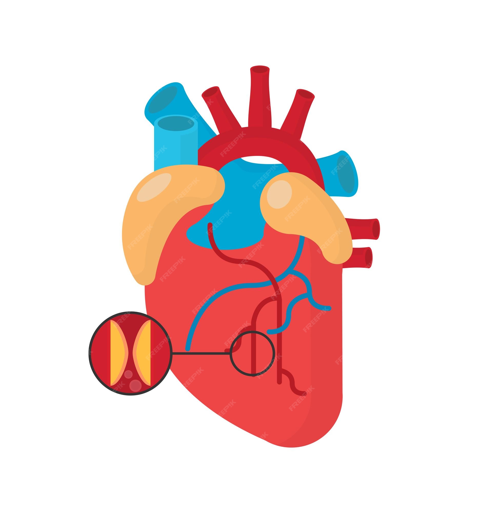 Premium Vector | Heart attack concept in flat style vector image