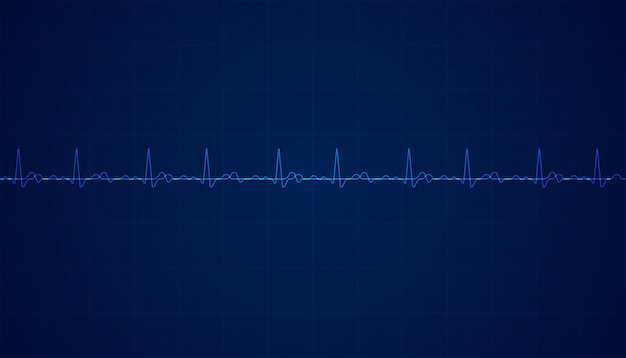 Vector heart beat pulse electrocardiogram rhythm on blue background