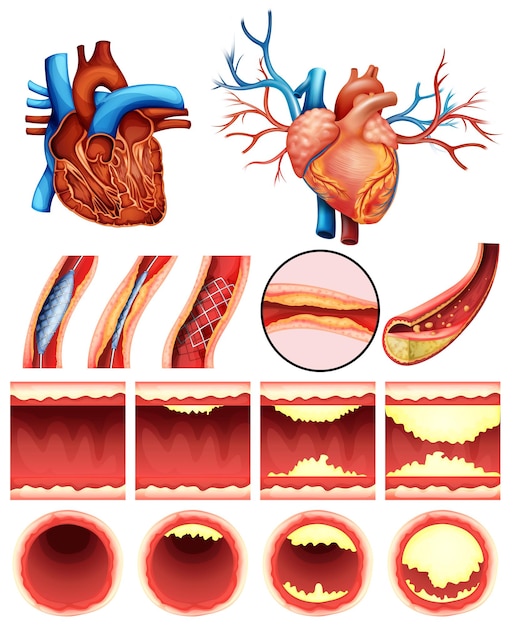 Vector heart cholesterol