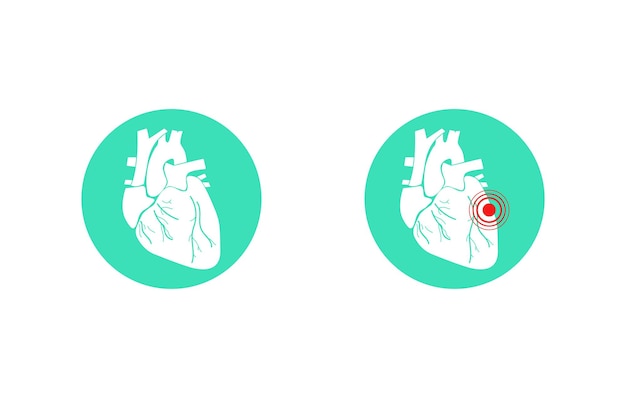 Vettore illustrazione dell'organo cardiaco per la progettazione medica icona vettore