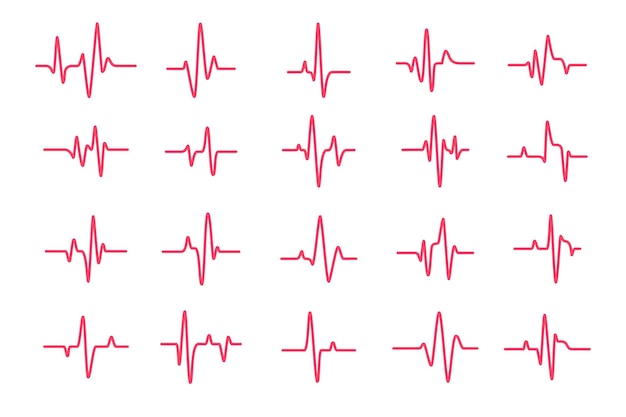 Heart rhythm graph Checking your heartbeat for diagnosis