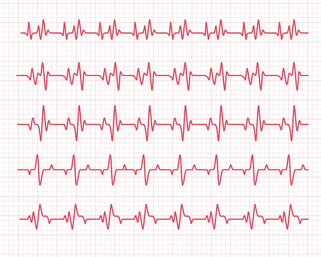 心拍数グラフ 診断のために心拍を確認する