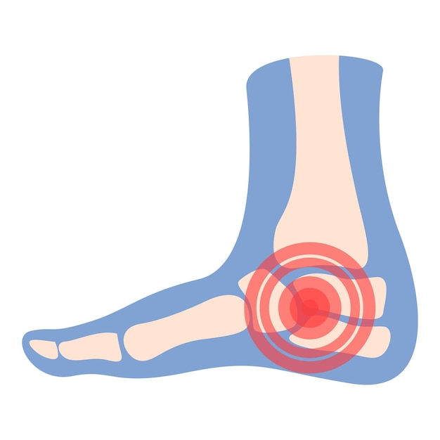 Vector heel pain icon cartoon vector arthritis joint medical treatment