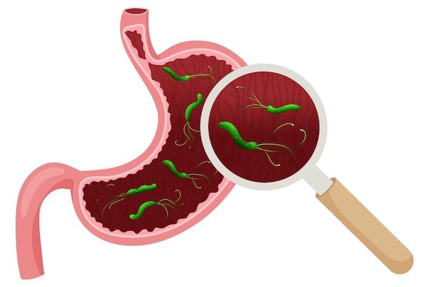 Helicobacter pylori in lege maag onder vergrootglas Vector illustratie cartoon stijl