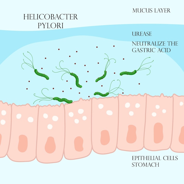 Vector helicobacter pylori in mucosal layer on epithelial cells in stomach