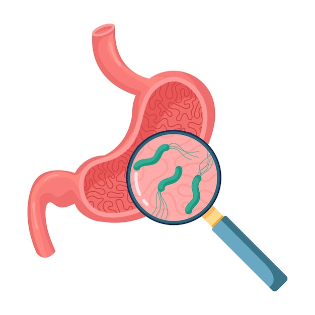 Helicobacter Pylori in the stomach Stomach diseases Bacterium with flagella that causes gastritis