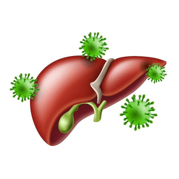 Epatite fegato umano con virus dell'infezione virale epatite