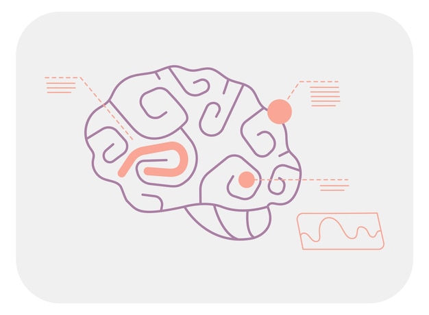 Hersengebieden scannen Neurologie functie medische infographic