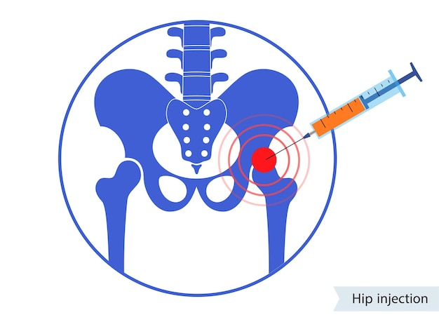 Vector hip joint injection