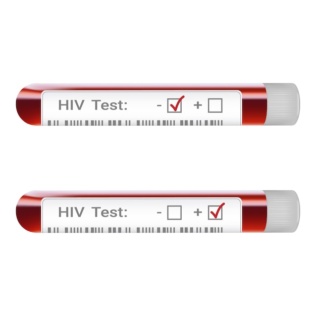 白い背景で隔離のHIV陽性および陰性のテスト結果を示す採血管によるHIVスクリーニングテスト結果の概念現実的なベクトル図