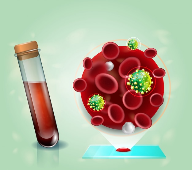 Hiv 바이러스 혈액 검사 현실적인 벡터 개념