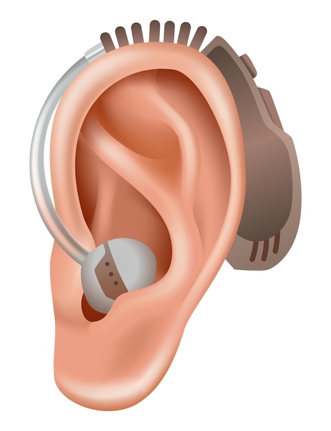 Vector hoortoestel geluidsversterker voor patiënten met gehoorverlies geneeskunde en gezondheid realistisch object achter het oor behandeling en protheses in de kno