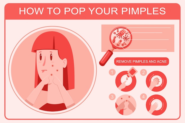How to pop pimple infographics vector cartoon illustration.