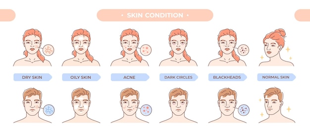 Vector huidconditie set vrouw en man zorgen voor schoonheid en gezondheid gezichten met acne en mee-eters