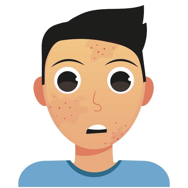 Huidprobleem, jonge man, acne vector