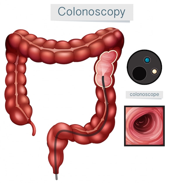 Colonscopia di anatomia umana su fondo bianco