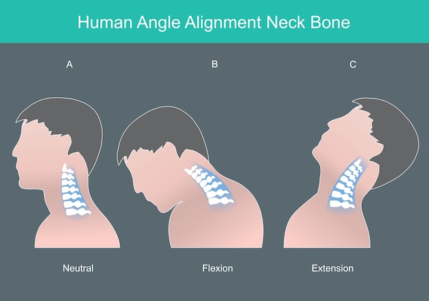 Vector human angle alignment neck bone human neck bone in correct angles illustration infographicxa