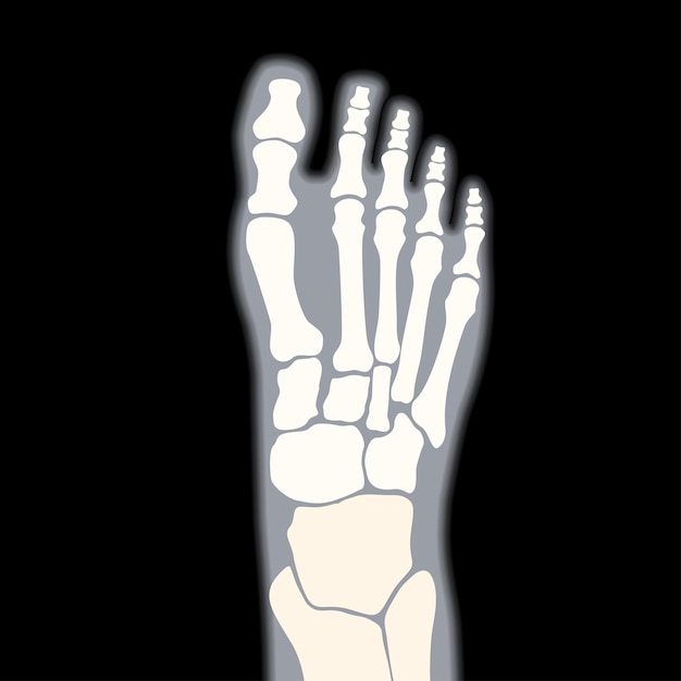 Vettore icona della caviglia umana per clinica. anatomia delle articolazioni e delle ossa del piede normale nella silhouette della gamba