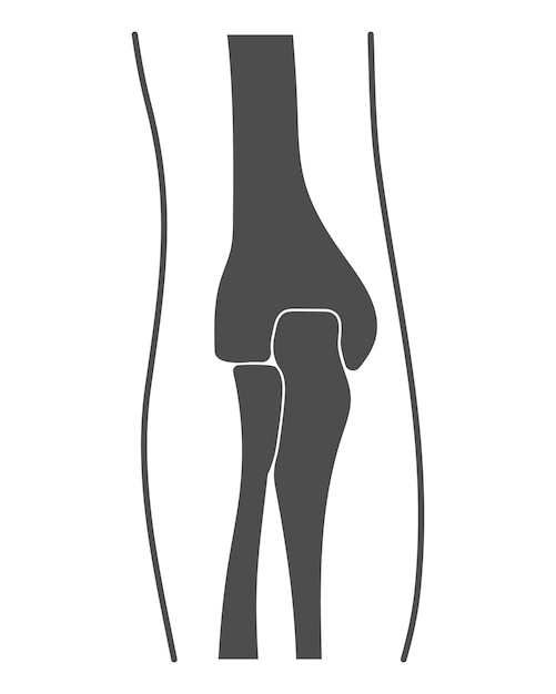 인간의 팔꿈치 관절 엠블럼 또는 의료 진단 센터 또는 클리닉 평면 디자인 벡터의 표시