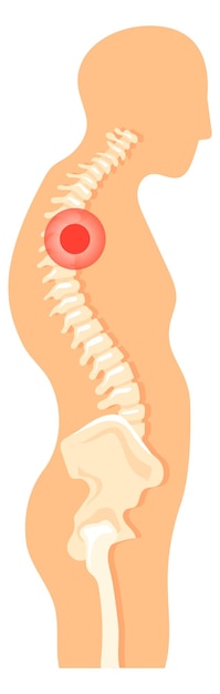 벡터 척추 통증 측면보기 해부학 일러스트와 함께 인간의 그림