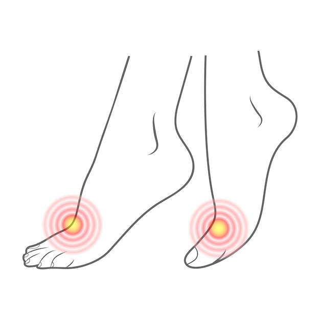 벡터 인간의 발 윤곽과 의학 및 정형 외과 절연에 대 한 고통 준비 요소의 붉은 반점